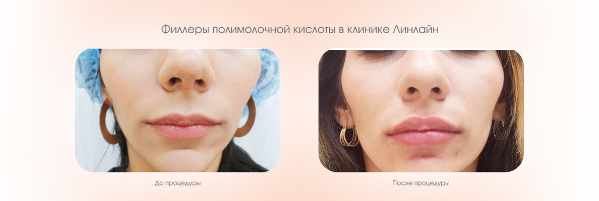 fc8ccf06-28e0-4ddf-9458-80a23bdcc638.JPG