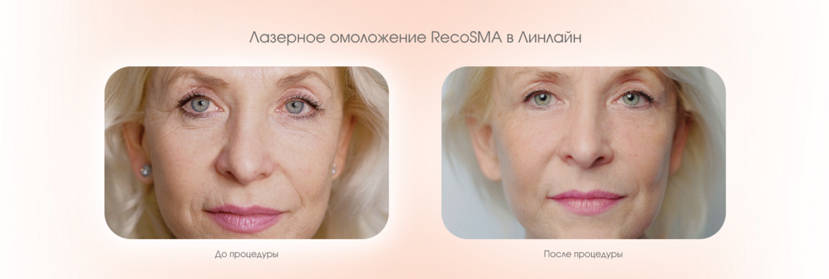 6b130378-a79f-4ff2-b937-ca9ca5f369a5.png